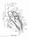 Fig. 35 - Transcatheter mitral valve prosthesis