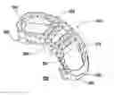 Fig. 01 - Spinal fusion implant