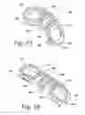 Fig. 06 - Spinal fusion implant