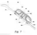 Fig. 08 - Spinal fusion implant