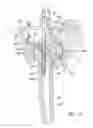 Fig. 08 - Method and apparatus for performing a less invasive shoulder procedure