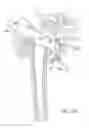 Fig. 10 - Method and apparatus for performing a less invasive shoulder procedure