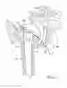 Fig. 12 - Method and apparatus for performing a less invasive shoulder procedure