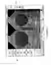 Fig. 07 - Ultrasound probe with accelerometer