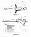 Fig. 05 - Method and apparatus for the diagnosis and prognosis of active implants in or attached to biological hosts or systems