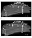 Fig. 31 - METHOD AND SYSTEM FOR DYNAMIC, THREE-DIMENSIONAL GEOLOGICAL INTERPRETATION AND MODELING