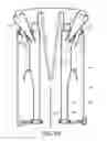 Fig. 11 - Surface treating appliance