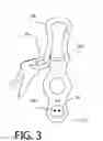 Fig. 04 - Bottle and Key Clip