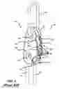 Fig. 02 - TENSIONING DEVICE