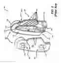 Fig. 03 - TENSIONING DEVICE