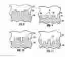 Fig. 08 - Method of Making a Combustion Turbine Component Having a Plurality of Surface Cooling Features and Associated Components