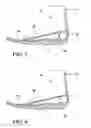 Fig. 04 - ACHILLES TENDON STRETCHING DEVICE