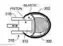 Fig. 01 - Vestibular canal plug