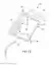 Fig. 02 - METHODS AND SYSTEMS FOR HOLDING SURGICAL INSTRUMENT COUNT SHEETS