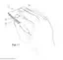 Fig. 08 - Apparatus for treating a stain in clothing