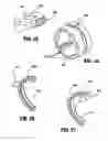 Fig. 16 - Surgical stapling device with independent tip rotation