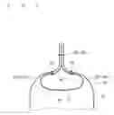 Fig. 03 - Airbag device