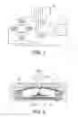 Fig. 02 - Detection system and method for detecting movements of a movable object