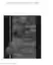 Fig. 03 - Apparatus and method for bidirectionally inpainting occlusion area based on predicted volume