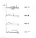 Fig. 09 - Method and apparatus for video processing for improved video compression