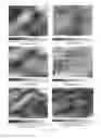 Fig. 16 - Imaging arrangement and microscope