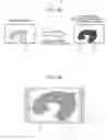 Fig. 22 - Microscope and area determination method