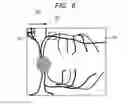 Fig. 07 - OPHTHALMOLOGIC APPARATUS AND OPHTHALMOLOGIC SYSTEM