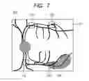 Fig. 08 - OPHTHALMOLOGIC APPARATUS AND OPHTHALMOLOGIC SYSTEM