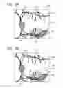 Fig. 09 - OPHTHALMOLOGIC APPARATUS AND OPHTHALMOLOGIC SYSTEM