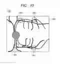 Fig. 11 - OPHTHALMOLOGIC APPARATUS AND OPHTHALMOLOGIC SYSTEM