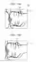 Fig. 12 - OPHTHALMOLOGIC APPARATUS AND OPHTHALMOLOGIC SYSTEM