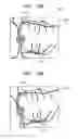 Fig. 14 - OPHTHALMOLOGIC APPARATUS AND OPHTHALMOLOGIC SYSTEM