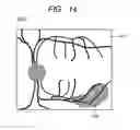 Fig. 15 - OPHTHALMOLOGIC APPARATUS AND OPHTHALMOLOGIC SYSTEM