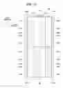 Fig. 04 - Backlight unit of liquid crystal display