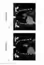 Fig. 03 - METHOD AND APPARATUS FOR BREATHING ADAPTED IMAGING