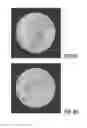 Fig. 09 - Optimized aperture selection imaging computed tomography system and method