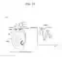 Fig. 18 - Hearing aid and hearing aid system