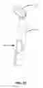 Fig. 16 - Earbud Headset Positioning Device