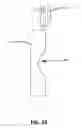Fig. 24 - Earbud Headset Positioning Device