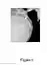 Fig. 06 - STENT LOCALIZATION IN 3D CARDIAC IMAGES