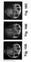 Fig. 10 - MOTION DETECTION AND CORRECTION IN MAGNETIC RESONANCE IMAGING FOR RIGID, NONRIGID, TRANSLATIONAL, ROTATIONAL, AND THROUGH-PLANE MOTION