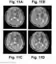Fig. 11 - MOTION DETECTION AND CORRECTION IN MAGNETIC RESONANCE IMAGING FOR RIGID, NONRIGID, TRANSLATIONAL, ROTATIONAL, AND THROUGH-PLANE MOTION