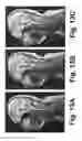 Fig. 13 - MOTION DETECTION AND CORRECTION IN MAGNETIC RESONANCE IMAGING FOR RIGID, NONRIGID, TRANSLATIONAL, ROTATIONAL, AND THROUGH-PLANE MOTION