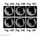 Fig. 15 - MOTION DETECTION AND CORRECTION IN MAGNETIC RESONANCE IMAGING FOR RIGID, NONRIGID, TRANSLATIONAL, ROTATIONAL, AND THROUGH-PLANE MOTION
