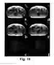 Fig. 19 - MOTION DETECTION AND CORRECTION IN MAGNETIC RESONANCE IMAGING FOR RIGID, NONRIGID, TRANSLATIONAL, ROTATIONAL, AND THROUGH-PLANE MOTION