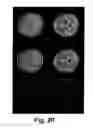 Fig. 20 - MOTION DETECTION AND CORRECTION IN MAGNETIC RESONANCE IMAGING FOR RIGID, NONRIGID, TRANSLATIONAL, ROTATIONAL, AND THROUGH-PLANE MOTION