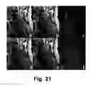 Fig. 21 - MOTION DETECTION AND CORRECTION IN MAGNETIC RESONANCE IMAGING FOR RIGID, NONRIGID, TRANSLATIONAL, ROTATIONAL, AND THROUGH-PLANE MOTION