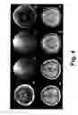 Fig. 05 - MAGNETIC RESONANCE PARTIALLY PARALLEL IMAGING (PPI) WITH MOTION CORRECTED COIL SENSITIVITIES