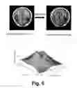 Fig. 07 - MAGNETIC RESONANCE PARTIALLY PARALLEL IMAGING (PPI) WITH MOTION CORRECTED COIL SENSITIVITIES