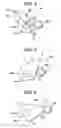 Fig. 05 - Fixing device including movable peeling plate